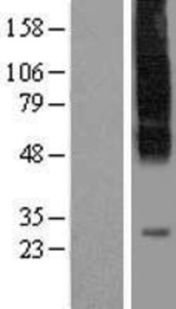 Novus Biologicals&trade;&nbsp;SLC35C1 Overexpression Lysate