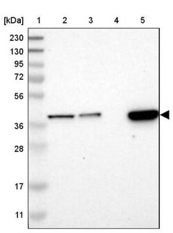 SLC35E1 Antibody, Novus Biologicals 25 &mu;L, Unlabeled:Antibodies, Polyclonal