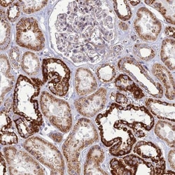 SLC35F4 Antibody, Novus Biologicals:Antibodies:Primary Antibodies