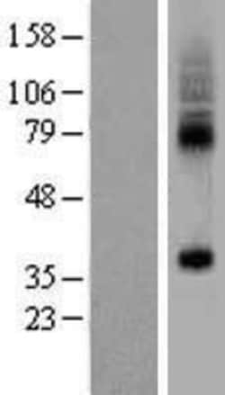 Novus Biologicals&trade;&nbsp;SLC35F5 Overexpression Lysate