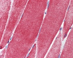 SLC36A2 Antibody, Novus Biologicals 0.05mg; Unlabeled:Antibodies, Polyclonal