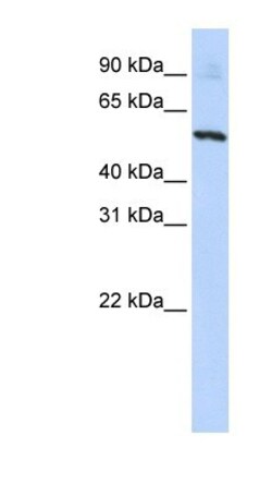 SLC36A2 Antibody, Novus Biologicals 0.05mg; Unlabeled:Antibodies, Polyclonal
