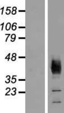 Novus Biologicals&trade;&nbsp;SLC36A2 Overexpression Lysate