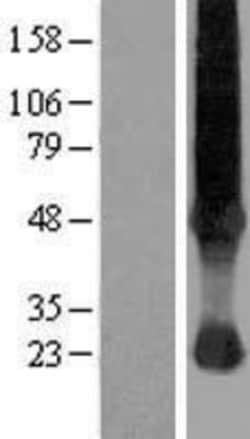 Novus Biologicals&trade;&nbsp;SLC37A4 Overexpression Lysate