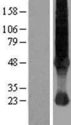 Novus Biologicals&trade;&nbsp;SLC37A4 Overexpression Lysate