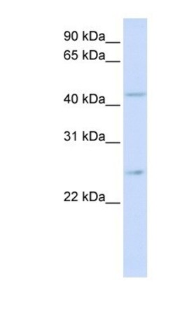SLC37A4 Antibody, Novus Biologicals 100 &mu;L | Buy Online | Novus Biologicals | Fisher Scientific