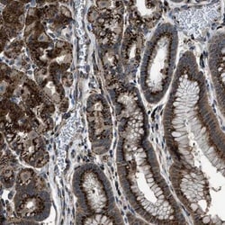 SLC38A10 Antibody, Novus Biologicals 0.1mL; Unlabeled:Antibodies, Polyclonal