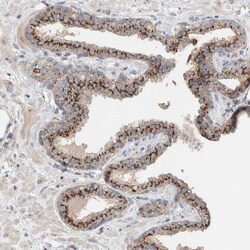 SLC38A10 Antibody, Novus Biologicals:Antibodies:Primary Antibodies