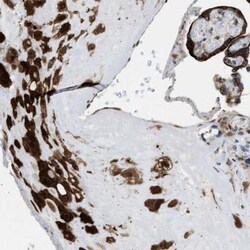 SLC38A10 Antibody, Novus Biologicals:Antibodies:Primary Antibodies