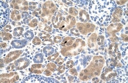 SLC38A1 Antibody, Novus Biologicals 0.1mg; Unlabeled:Antibodies, Polyclonal
