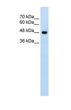 SLC38A1 Antibody, Novus Biologicals 0.1mg; Unlabeled:Antibodies, Polyclonal