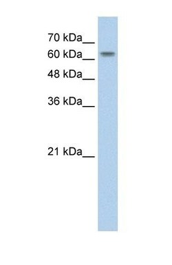 SLC38A1 Antibody, Novus Biologicals 0.1mg; Unlabeled:Antibodies, Polyclonal