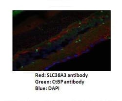 SLC38A3 Antibody, Novus Biologicals 20μL; Unlabeled:Antibodies, Polyclonal