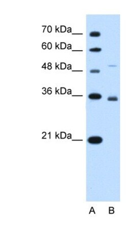 SLC38A3 Antibody, Novus Biologicals 20μL; Unlabeled:Antibodies, Polyclonal