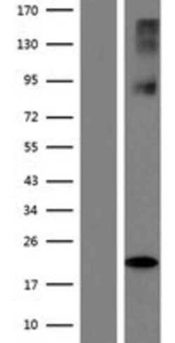 Novus Biologicals&trade;&nbsp;SLC38A6 Overexpression Lysate