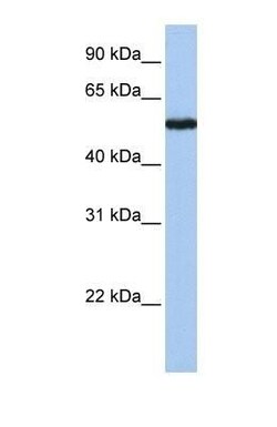 SLC38A9 Antibody, Novus Biologicals 0.05mg; Unlabeled:Antibodies, Polyclonal
