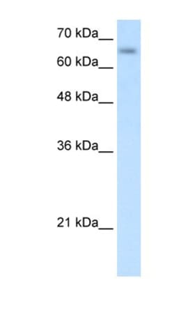SLC39A12 Antibody, Novus Biologicals:Antibodies:Primary Antibodies