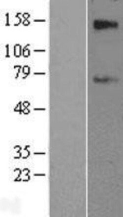 Novus Biologicals&trade;&nbsp;SLC39A12 Overexpression Lysate