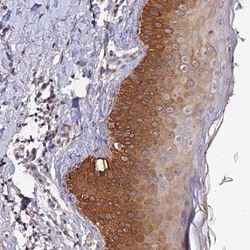 SLC39A13 Antibody, Novus Biologicals 0.1mL; Unlabeled:Antibodies, Polyclonal