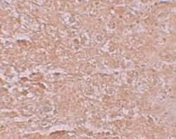 SLC39A14 Antibody - BSA Free, Novus Biologicals 0.025 mg, Unconjugated:Antibodies,