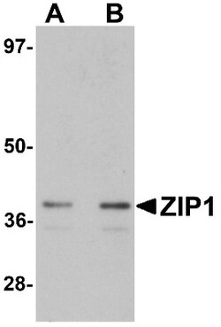 SLC39A1 Antibody - BSA Free, Novus Biologicals 0.1mg; Unlabeled:Antibodies,