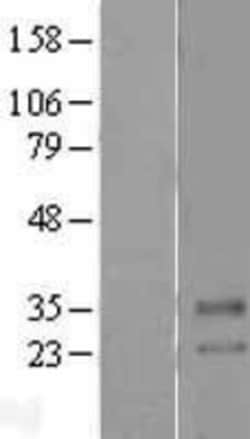 Novus Biologicals SLC39A2/ZIP2 Overexpression Lysate 0,1 mg | Buy Online | Novus Biologicals&trade; | Fisher Scientific