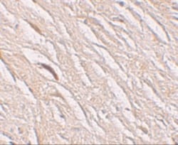 SLC39A2/ZIP2 Antibody - BSA Free, Novus Biologicals 0.1mg; Unlabeled:Antibodies,