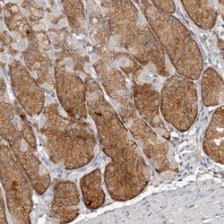 SLC39A2/ZIP2 Antibody, Novus Biologicals 0.1 mL | Buy Online | Novus Biologicals | Fisher Scientific