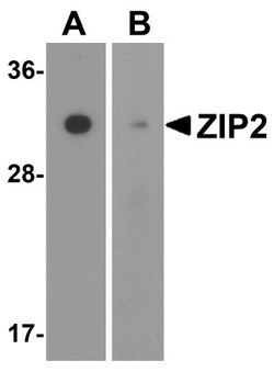 SLC39A2/ZIP2 Antibody - BSA Free, Novus Biologicals 0.1mg; Unlabeled:Antibodies,