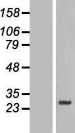 Novus Biologicals&trade;&nbsp;SLC39A3 Overexpression Lysate