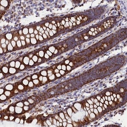 SLC39A3 Antibody, Novus Biologicals:Antibodies:Primary Antibodies