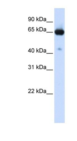 SLC39A4/ZIP4 Antibody, Novus Biologicals 0.05mg; Unlabeled:Antibodies,