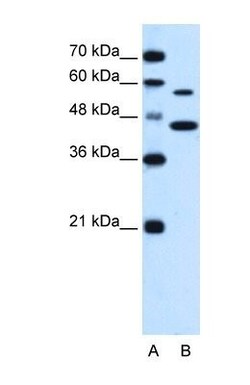 SLC39A5 Antibody, Novus Biologicals 0.05mg; Unlabeled:Antibodies, Polyclonal