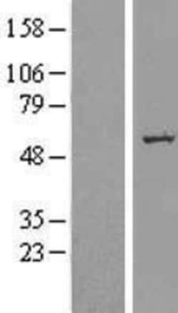 Novus Biologicals SLC39A7/ZIP7 Overexpression Lysate 0.1 mg | Buy Online | Novus Biologicals&trade; | Fisher Scientific