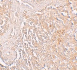 SLC39A8/ZIP8 Antibody - BSA Free, Novus Biologicals 0.1mg; Unlabeled:Antibodies,