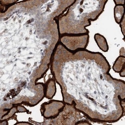 SLC39A8/ZIP8 Antibody, Novus Biologicals 0.1mL; Unlabeled:Antibodies, Polyclonal