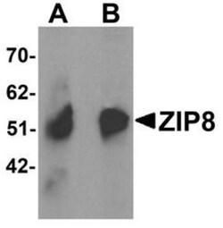SLC39A8/ZIP8 Antibody - BSA Free, Novus Biologicals 0.1mg; Unlabeled:Antibodies,