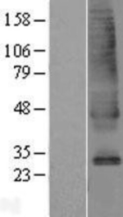 Novus Biologicals&trade;&nbsp;SLC39A9/ZIP9 Overexpression Lysate