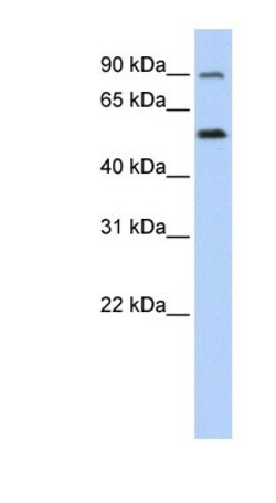 SLC41A1 Antibody, Novus Biologicals 0.05mg; Unlabeled:Antibodies, Polyclonal