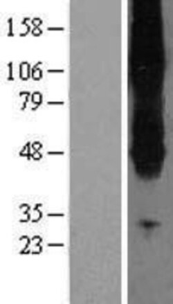 Novus Biologicals™ SLC43A2 Overexpression Lysate