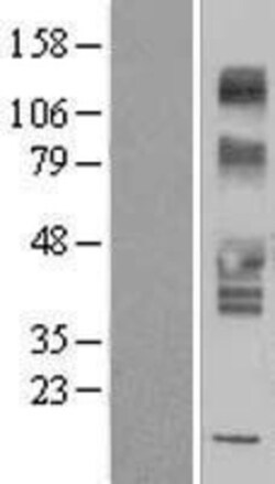 Novus Biologicals&trade;&nbsp;SLC43A3 Overexpression Lysate