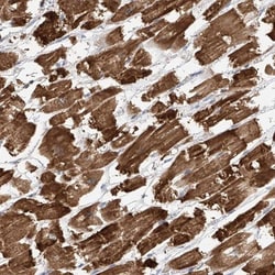 SLC43A3 Antibody, Novus Biologicals 25ul | Buy Online | Novus Biologicals | Fisher Scientific