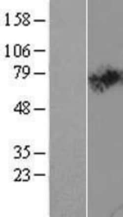 Novus Biologicals&trade;&nbsp;SLC44A2 Overexpression Lysate
