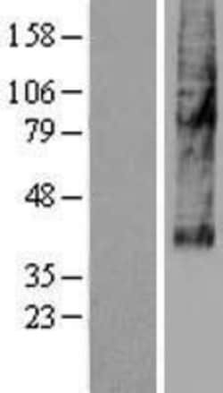 Novus Biologicals&trade;&nbsp;SLC46A3 Overexpression Lysate