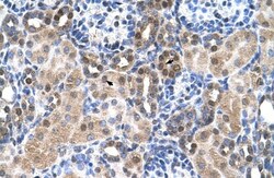 SLC46A3 Antibody, Novus Biologicals 0.1mg; Unlabeled:Antibodies, Polyclonal