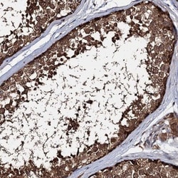 SLC46A3 Antibody, Novus Biologicals:Antibodies:Primary Antibodies