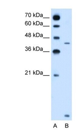 SLC46A3 Antibody, Novus Biologicals 0.1mg; Unlabeled:Antibodies, Polyclonal
