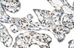 SLC48A1 Antibody, Novus Biologicals 0.05mg; Unlabeled:Antibodies, Polyclonal