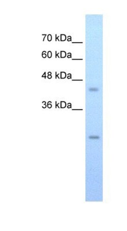 SLC48A1 Antibody, Novus Biologicals 0.05mg; Unlabeled:Antibodies, Polyclonal