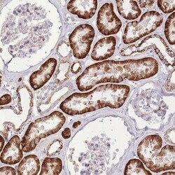 SLC4A4 Antibody, Novus Biologicals 0.1mL; Unlabeled:Antibodies, Polyclonal